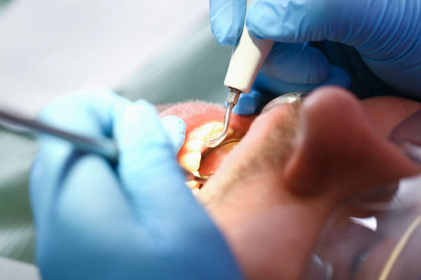 Best Emergency Dental Filling Replacement  in Mcrae Helena, GA