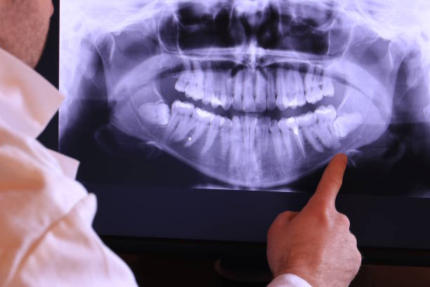 Best Dentist for Tooth Abscess  in Mcrae Helena, GA